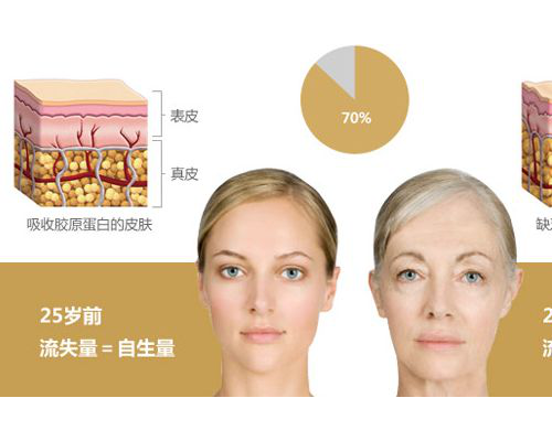 昕芙丽：第三代重组人源胶原蛋白-来自人体DNA的高阶胶原修复