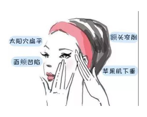 自体脂肪填充的秘密，你知道多少?