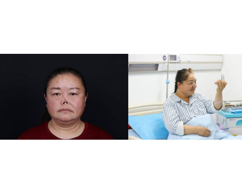 师俊莉揭秘女性医美医生独特优势：愿意与患者共情
